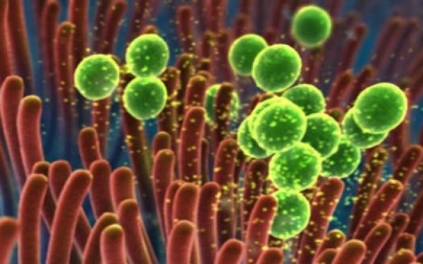 Biofilm i problemi vezani za čišćenje i dezinfekciju klima uređaja